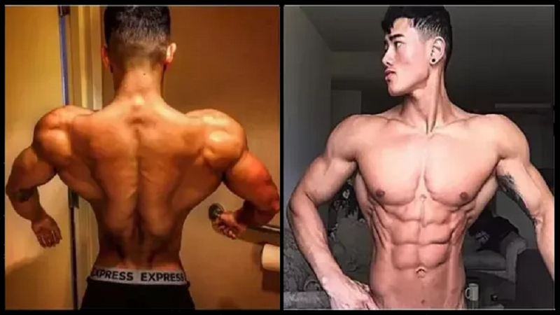 Abnormal body shape